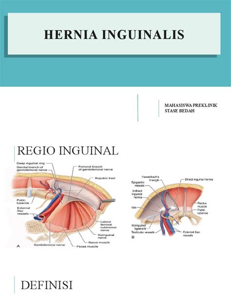 hernia inguinalis pdf